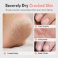 💧 50% RABATT NU! Fuktgivande vaselinstick för torra händer och fötter – squalan, hyaluronsyra & handsfri applicering – perfekt för sprucken hud och daglig vård ✨
